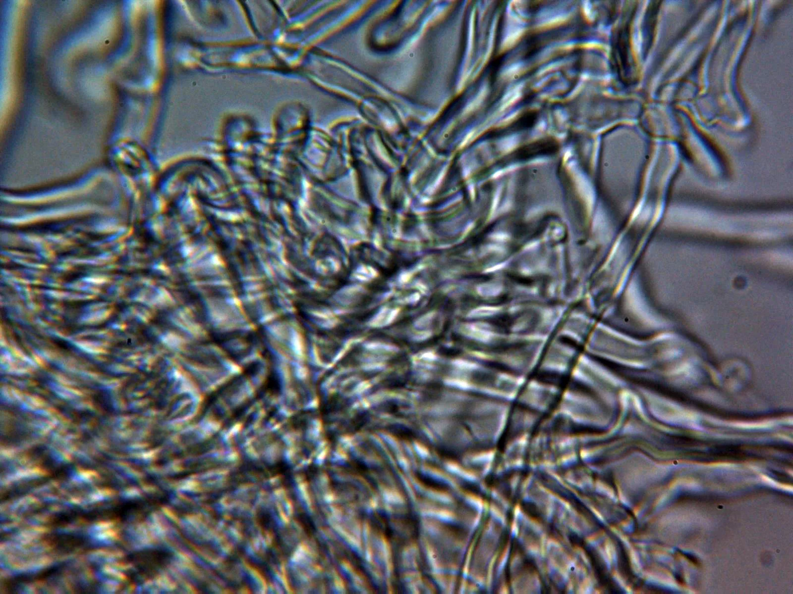 Microscopía de Rigidoporus microporus - 10 - Hifas KOH 2
